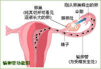 輸卵管炎癥怎么治療